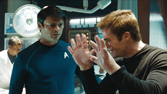 Kirk's big, allergic reaction hands... What does this have to do with Star Trek?